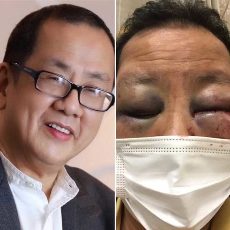 Danilo Yu Chang was beaten up without warning in San Francisco. FACEBOOK