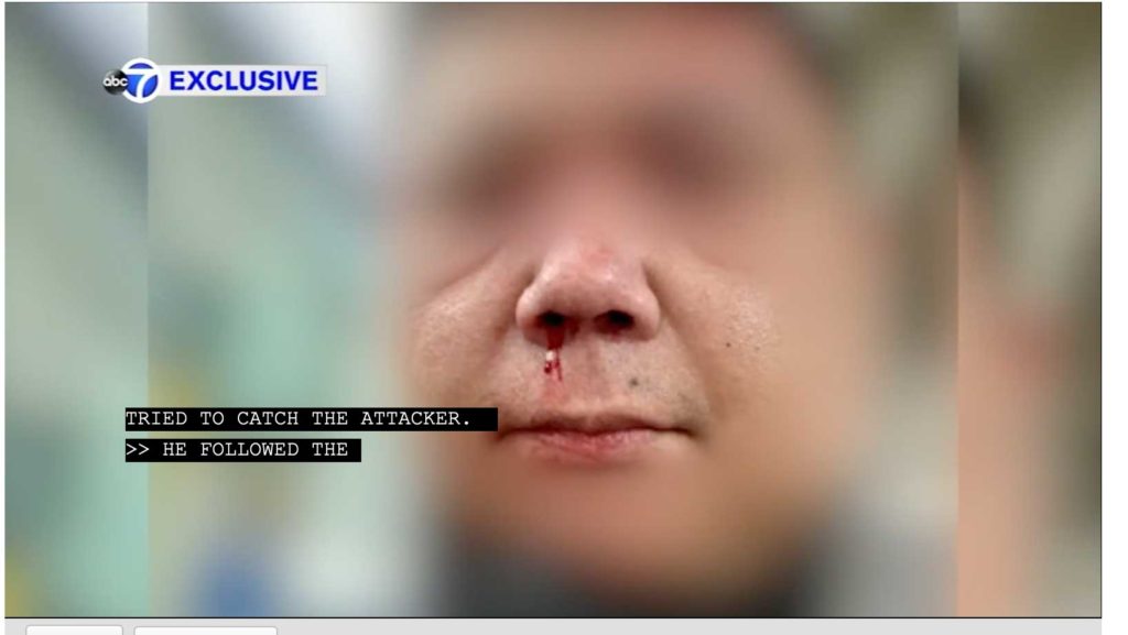 The Filipino victim, who didn't wish to be named, suffered facial injuries. WABC SCREENSHOT