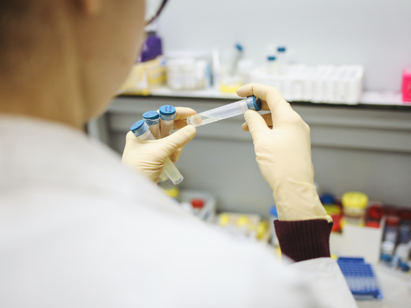 Oxford develop method thru blood test predictor of vaccine efficiency