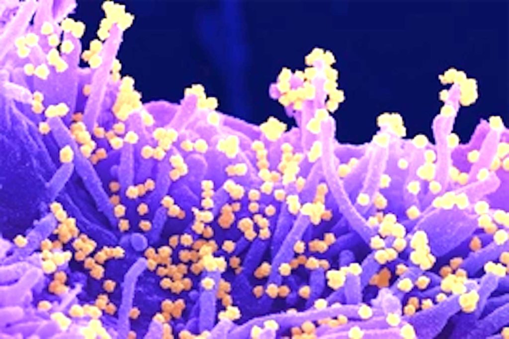 An image of the novel coronavirus captured and colorized at Rocky Mountain Laboratories in Hamilton, Montana. (NIAID / FLICKR)