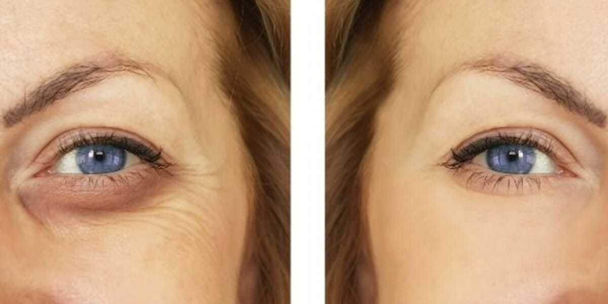 The Best Eyelid Lift Tapes You Can Buy in 2022