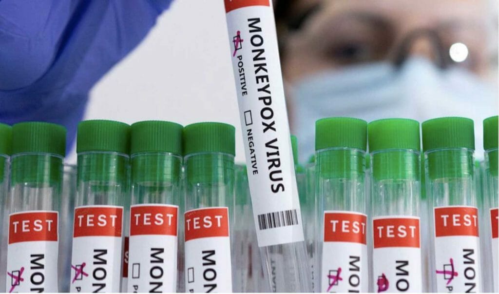 Test tubes marked “monkeypox virus.” REUTERS