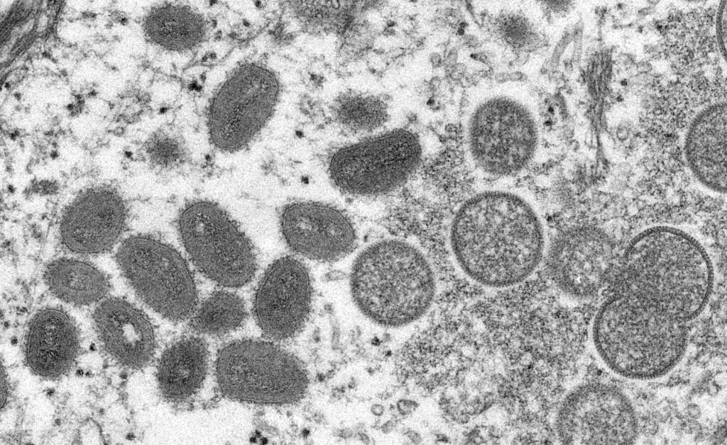 An electron microscope image shows mature oval-shaped monkeypox virus particles. REUTERS