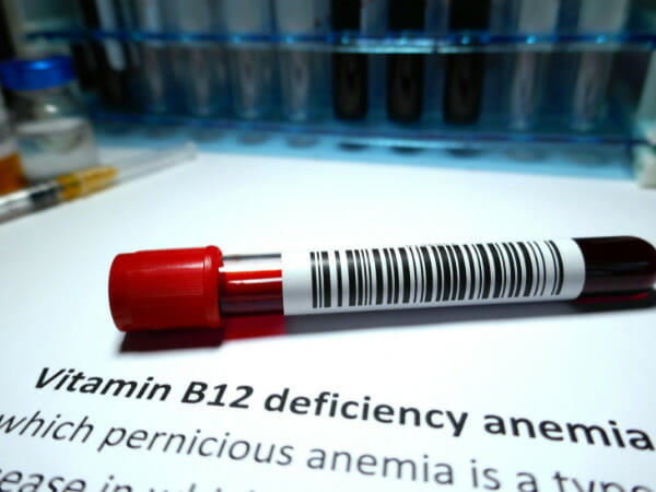 Symptoms Of Vitamin B12 Deficiency