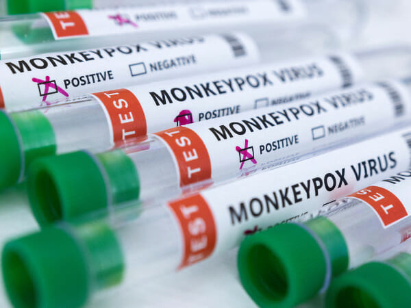 US works to expand monkeypox testing as cases increase
