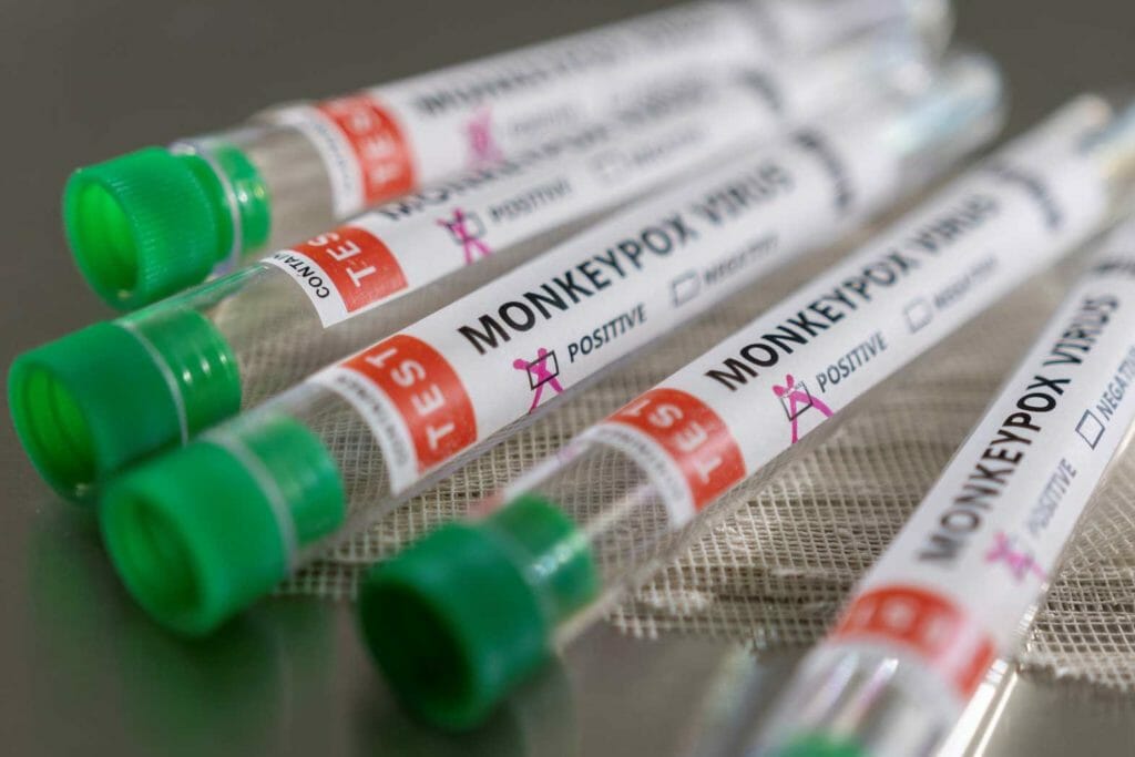 Test tubes labeled "Monkeypox virus positive" are seen in this illustration taken May 22, 2022. REUTERS/Dado Ruvic/Illustration