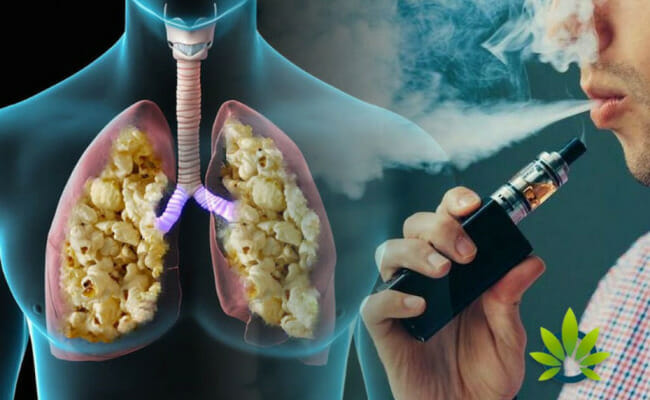 Effects of vaping on health