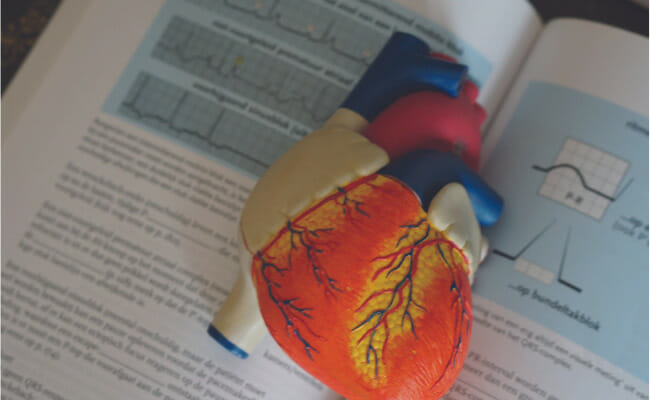 Fourth Frontier EKG for heart attack prevention