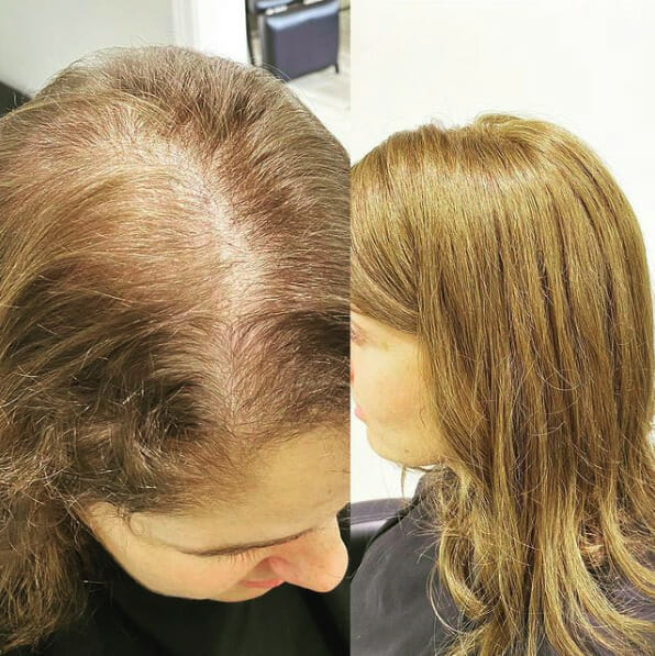 How Noelle Salon Manages Hair Loss