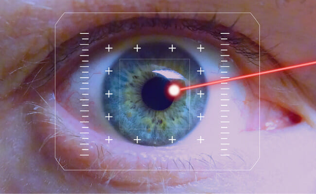 This represents laser eye surgery.