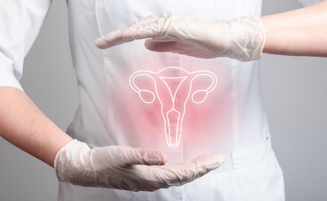 Understanding Polycystic Ovary Syndrome (PCOS)