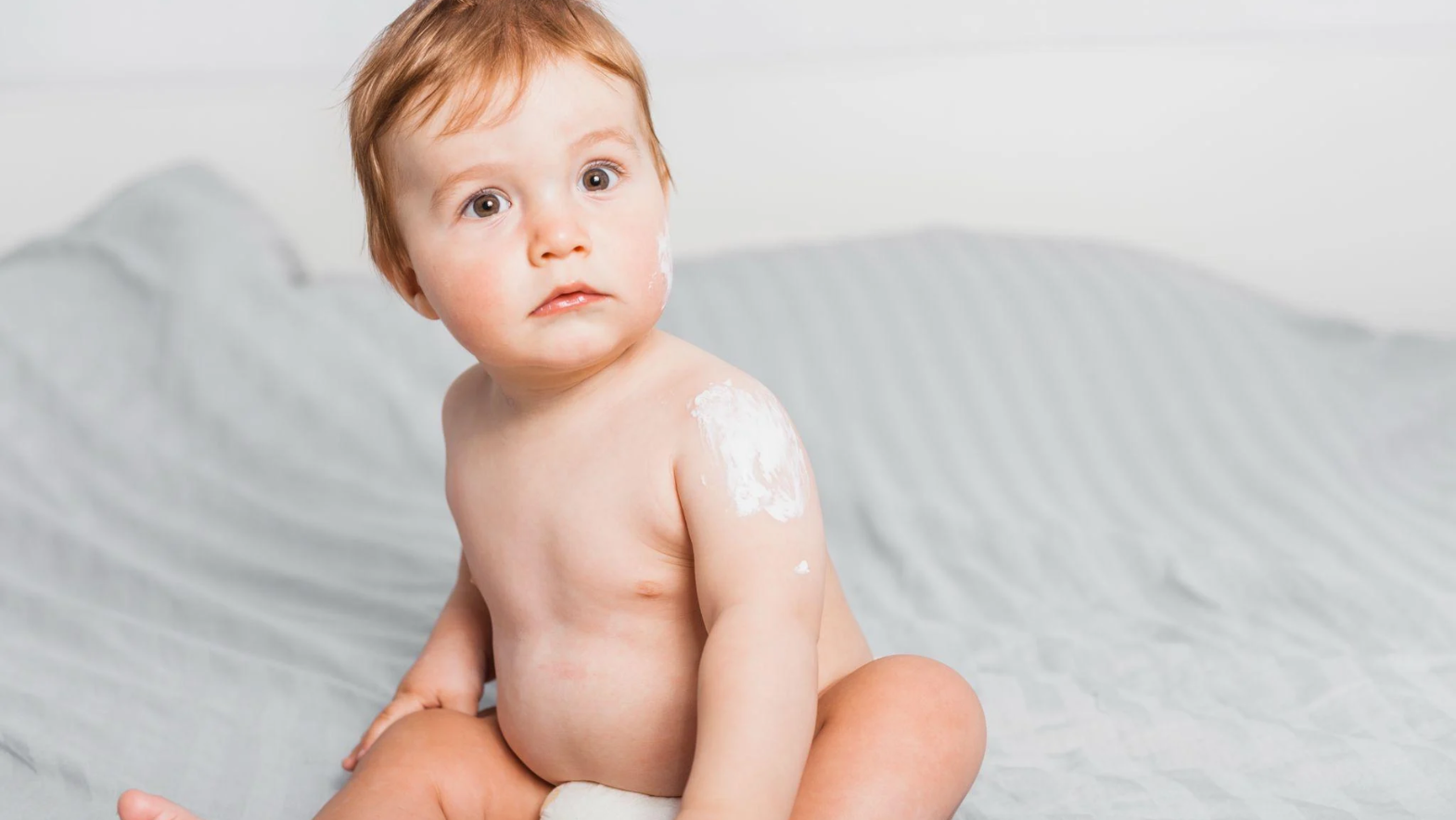 Benefits of Baby Foreskin Lotion for Infant Skin Conditions