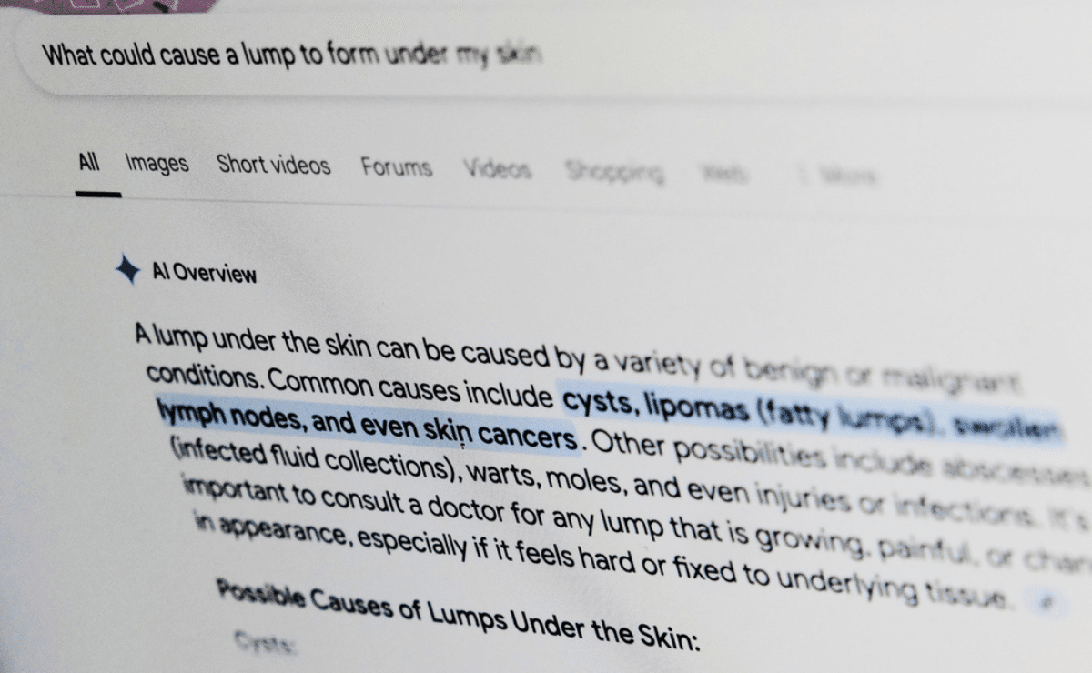 What’s that rash? Put some thought into asking Google for medical help